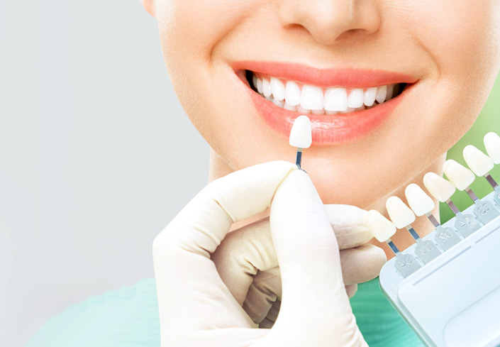 Modern Dentistry of Jupiter | Dental Veneers