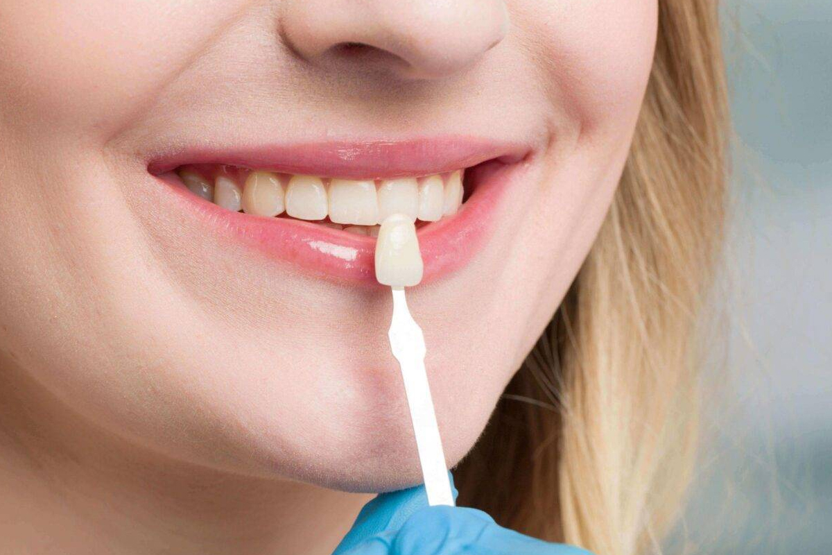 Modern Dentistry of Jupiter | Are Veneers Right for You? Find Out Today!