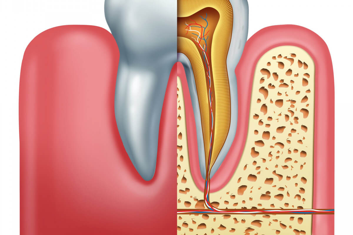 Modern Dentistry of Jupiter | Root Canal in Jupiter: 3 Quick Facts