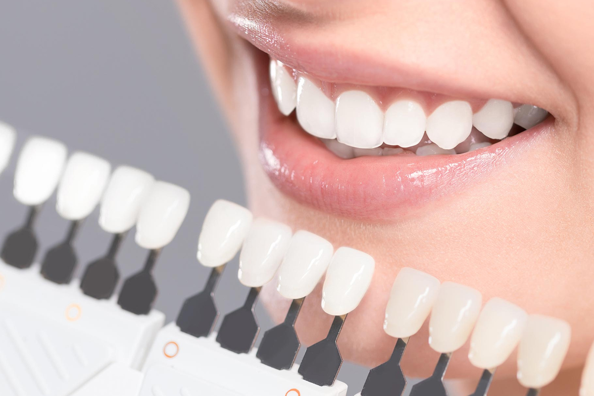 Modern Dentistry of Jupiter | See the Benefits of Same Day Crowns in Jupiter