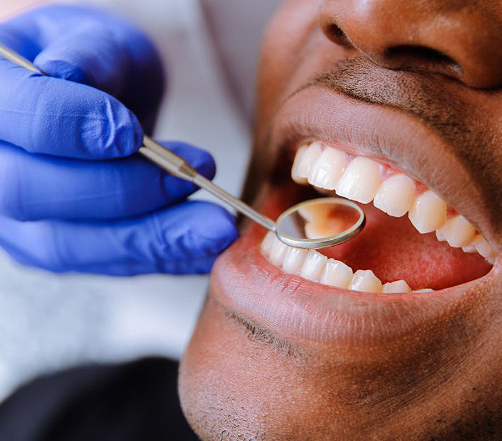 Modern Dentistry of Jupiter | Oral Cancer Screening
