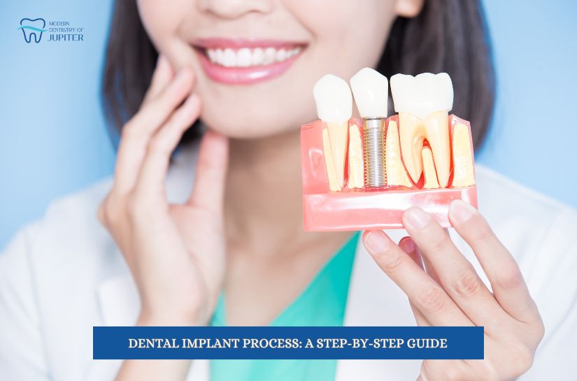 Modern Dentistry of Jupiter | Your Comprehensive Guide to the Dental Implant Process