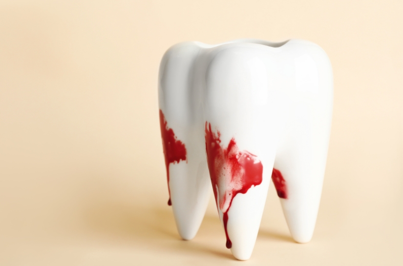 Modern Dentistry of Jupiter | Bleeding After Tooth Extraction: Know How to Stop It and Keep Calm Modern Dentistry of Jupiter | Bleeding After Tooth Extraction: Know How to Stop It and Keep Calm