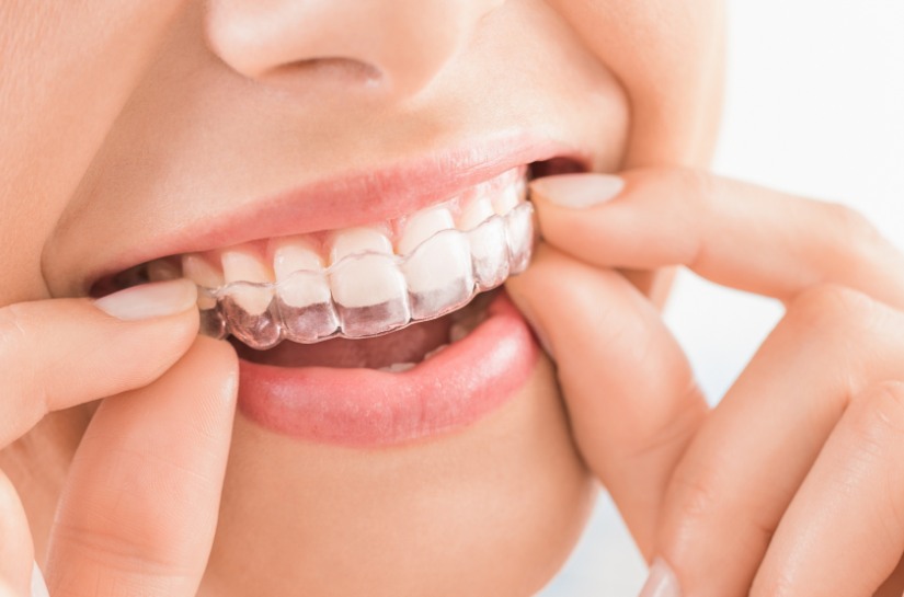 Modern Dentistry of Jupiter | Flossing with Invisalign: Tips for Maintaining Oral Health