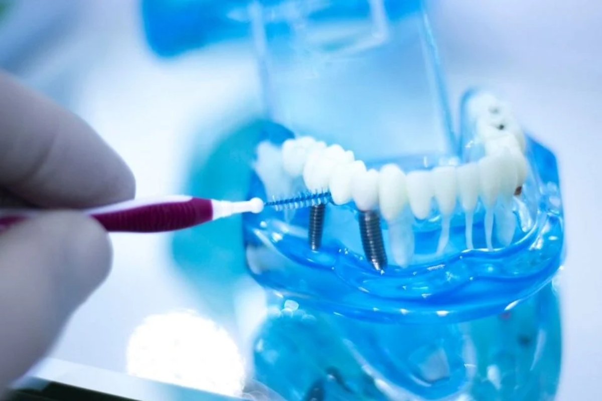 Modern Dentistry of Jupiter | How to Brush Around a Dental Implant: A Guide to Proper Care