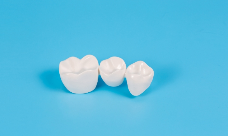 Modern Dentistry of Jupiter | The Role of Dental Bridges in Oral Health