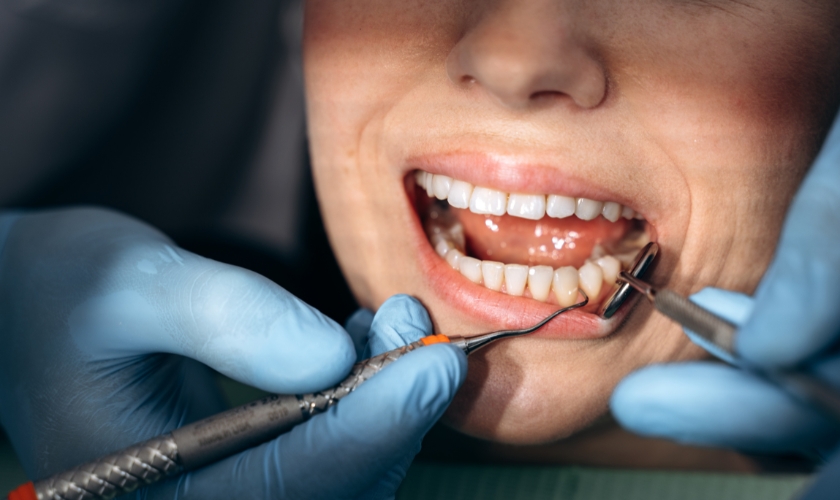 Modern Dentistry of Jupiter | Gum Graft Aftercare: Essential Tips from Modern Dentistry of Jupiter