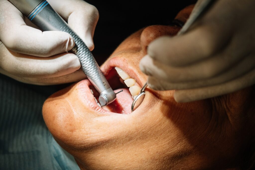 Modern Dentistry of Jupiter | Can You Get Dental Implants After Missing Teeth for 10+ Years? Modern Dentistry of Jupiter | Can You Get Dental Implants After Missing Teeth for 10+ Years?