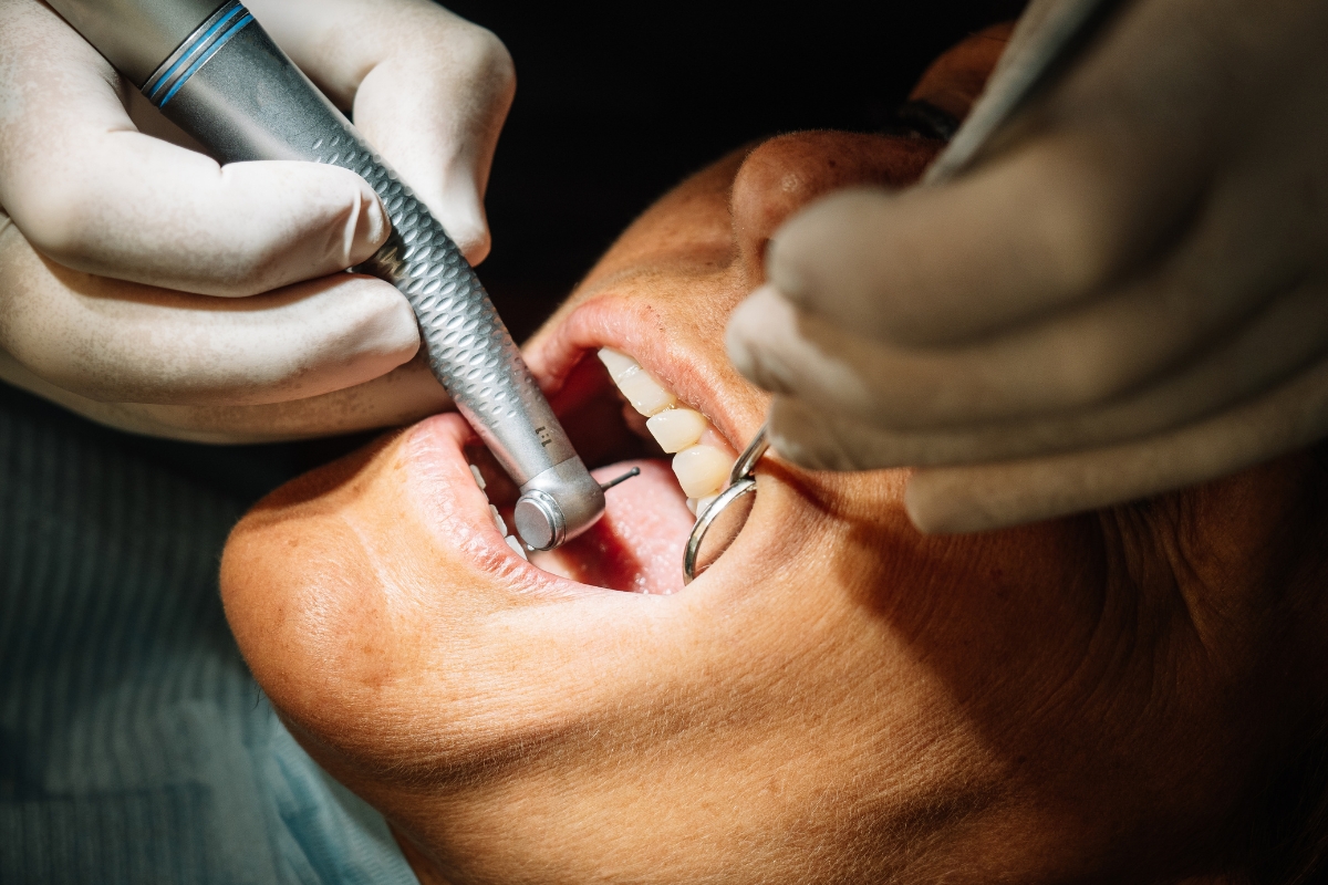 Modern Dentistry of Jupiter | Can You Get Dental Implants After Missing Teeth for 10+ Years?