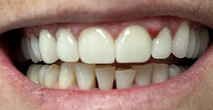 Modern Dentistry of Jupiter | Smile Gallery