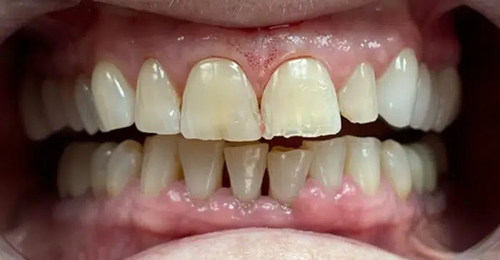 Modern Dentistry of Jupiter | Smile Gallery