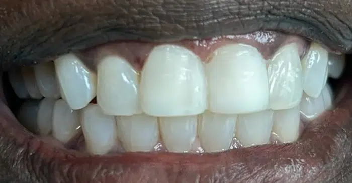Modern Dentistry of Jupiter | Smile Gallery