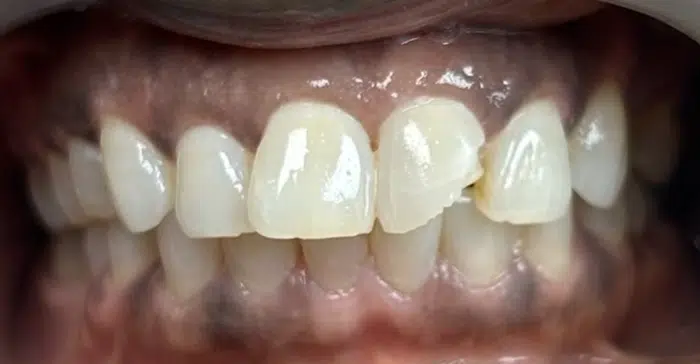 Modern Dentistry of Jupiter | Smile Gallery