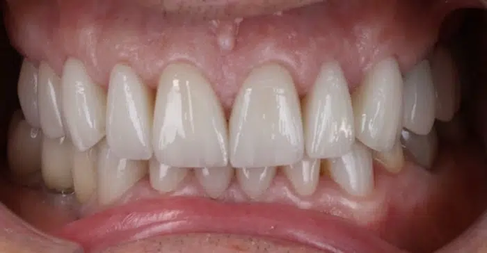 Modern Dentistry of Jupiter | Smile Gallery