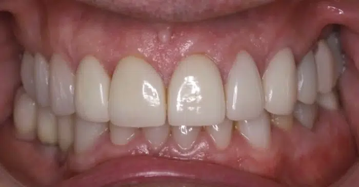 Modern Dentistry of Jupiter | Smile Gallery