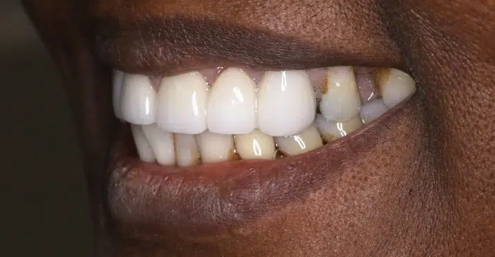 Modern Dentistry of Jupiter | Smile Gallery