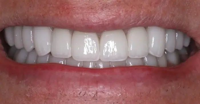 Modern Dentistry of Jupiter | Smile Gallery