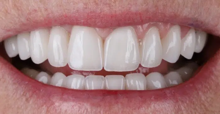 Modern Dentistry of Jupiter | Smile Gallery
