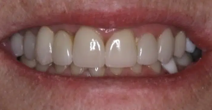 Modern Dentistry of Jupiter | Smile Gallery