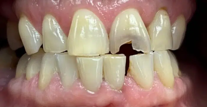 Modern Dentistry of Jupiter | Smile Gallery