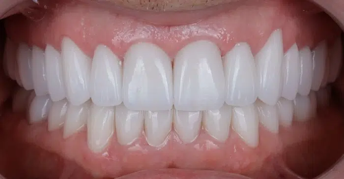 Modern Dentistry of Jupiter | Smile Gallery