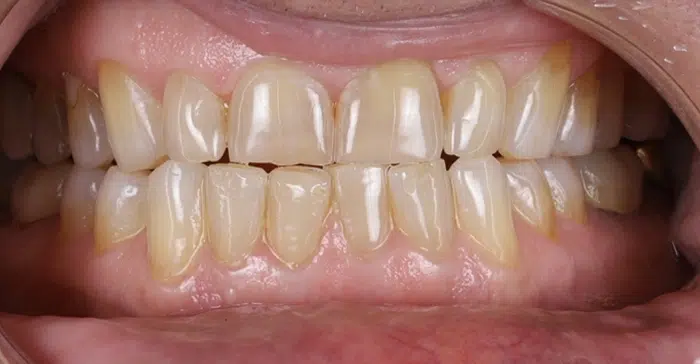 Modern Dentistry of Jupiter | Smile Gallery