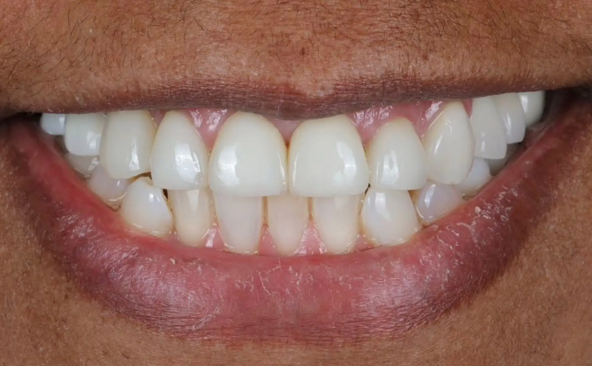 Modern Dentistry of Jupiter | Smile Gallery