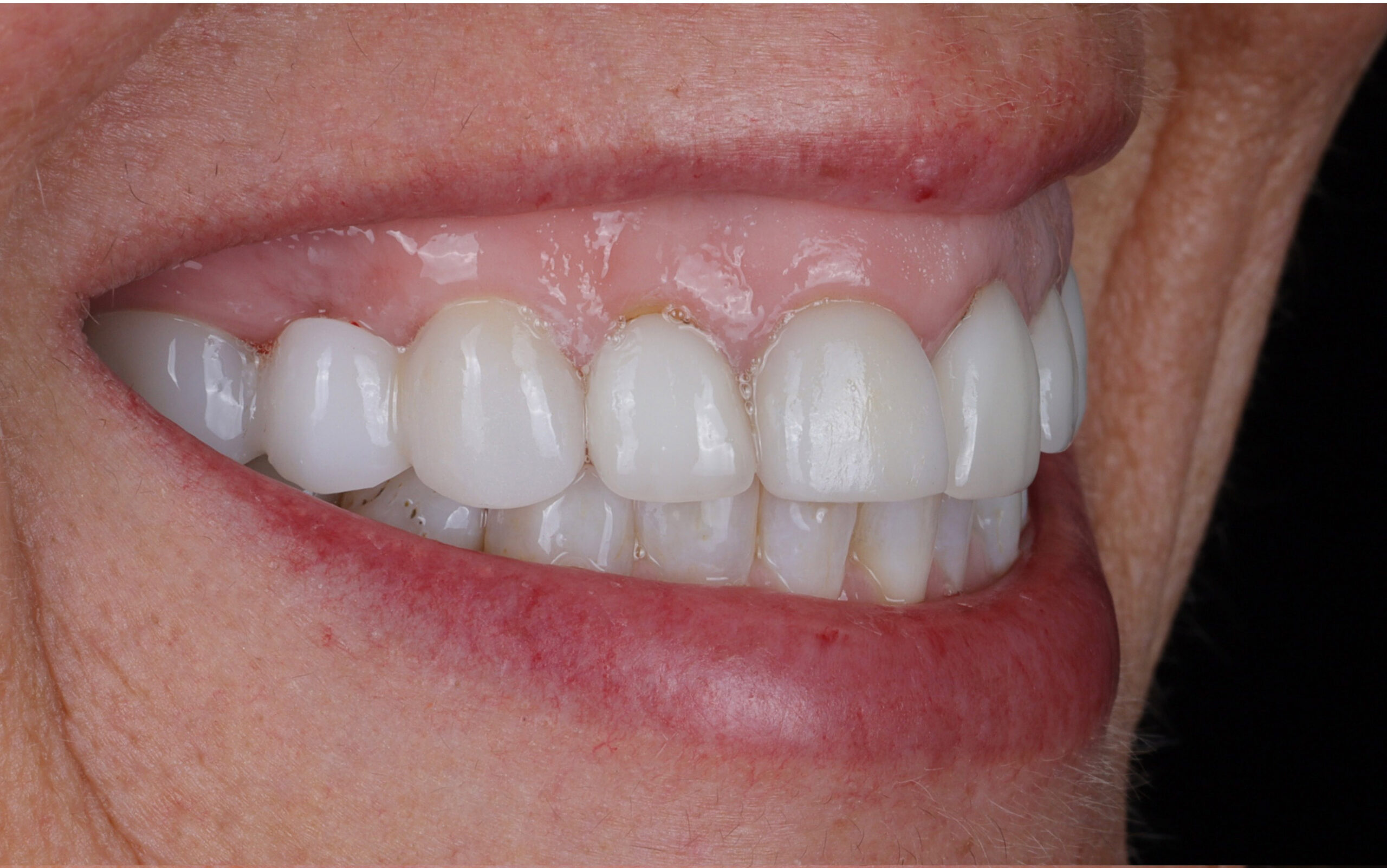 Modern Dentistry of Jupiter | Smile Gallery