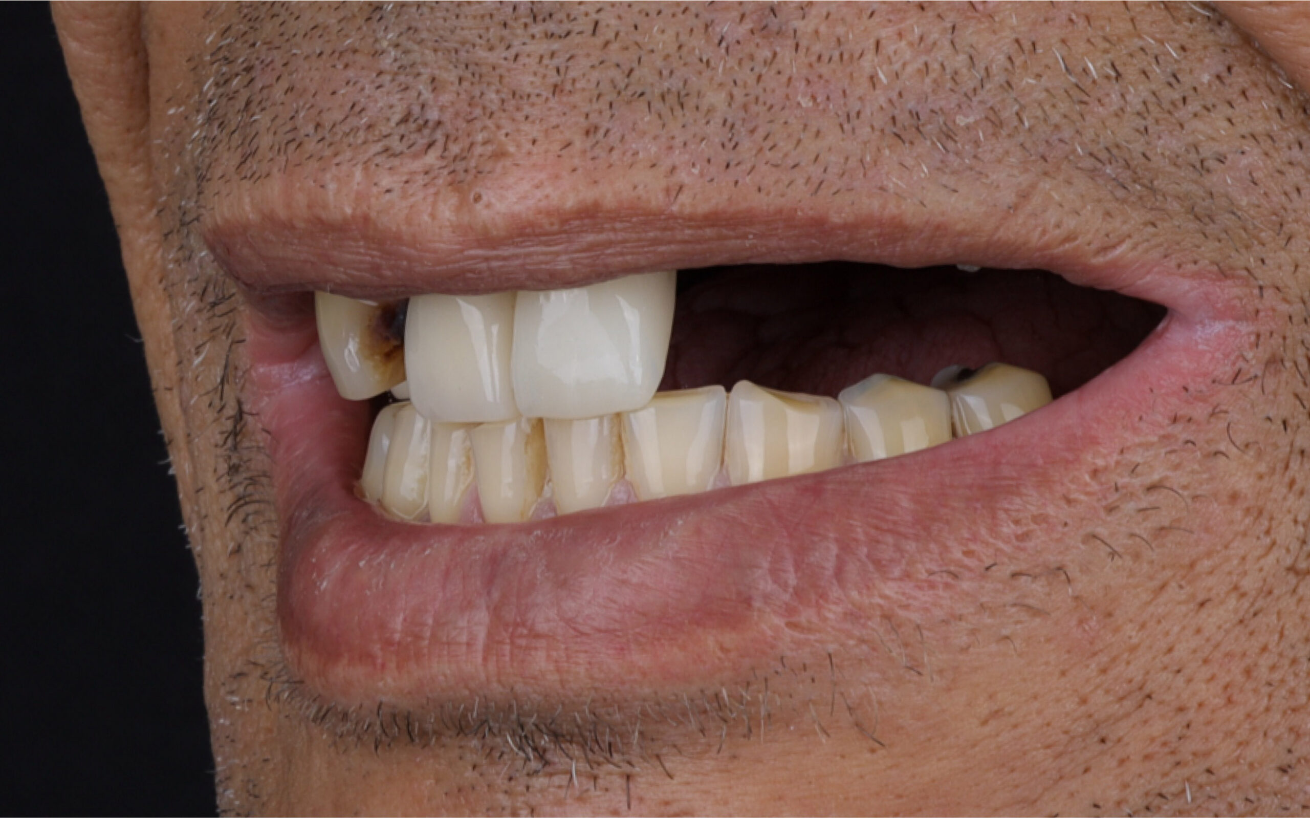 Modern Dentistry of Jupiter | Smile Gallery