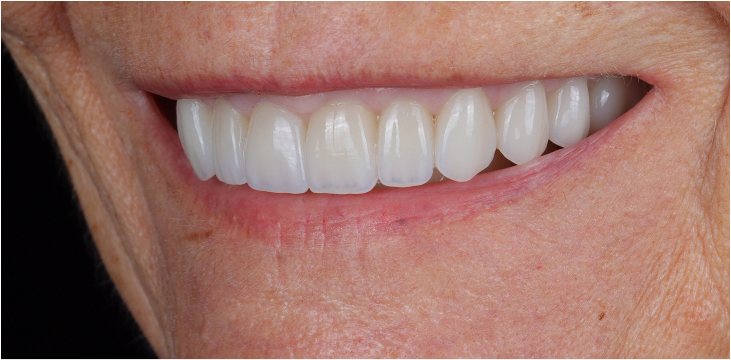 Modern Dentistry of Jupiter | Smile Gallery
