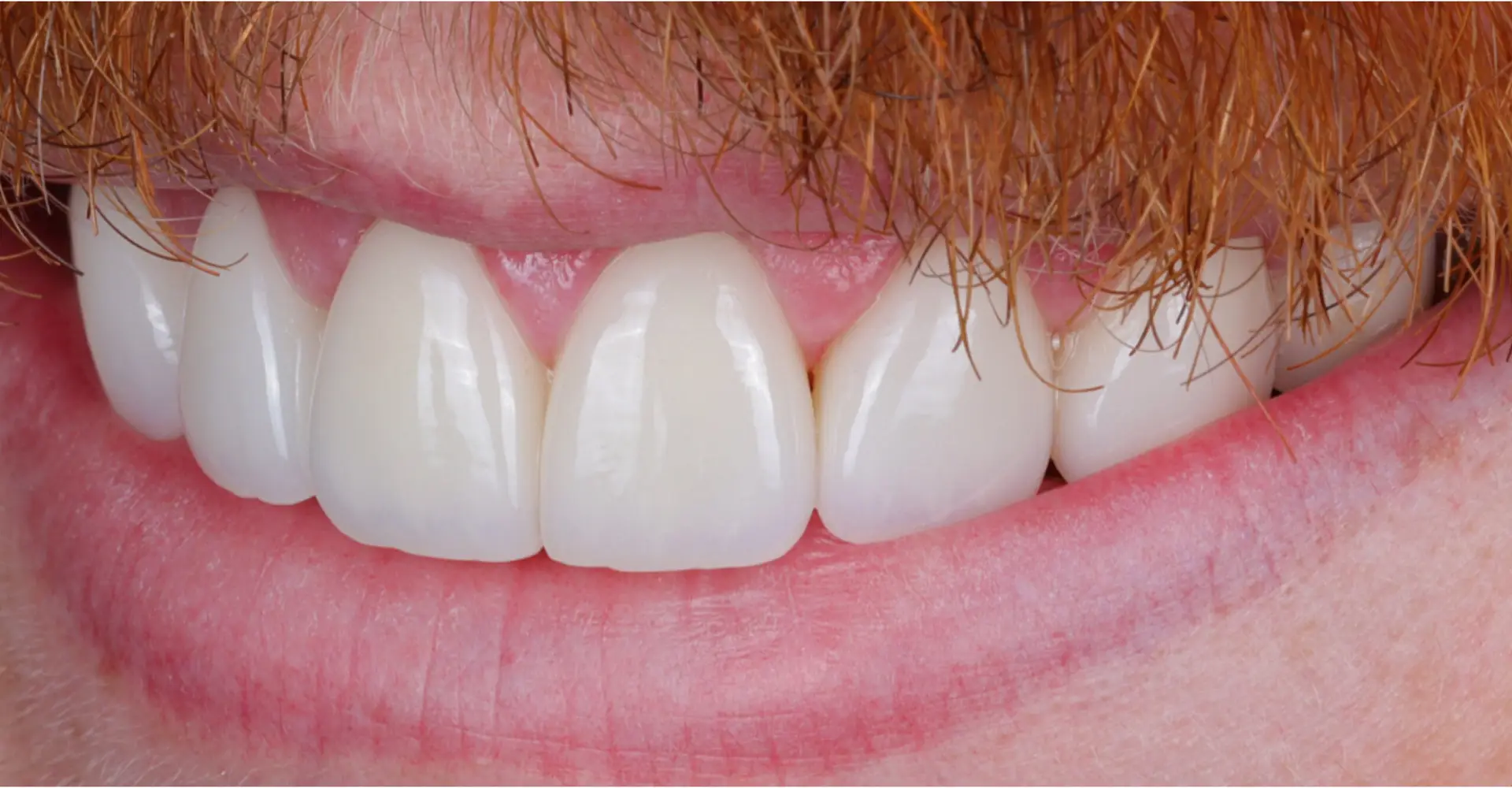 Modern Dentistry of Jupiter | Smile Gallery