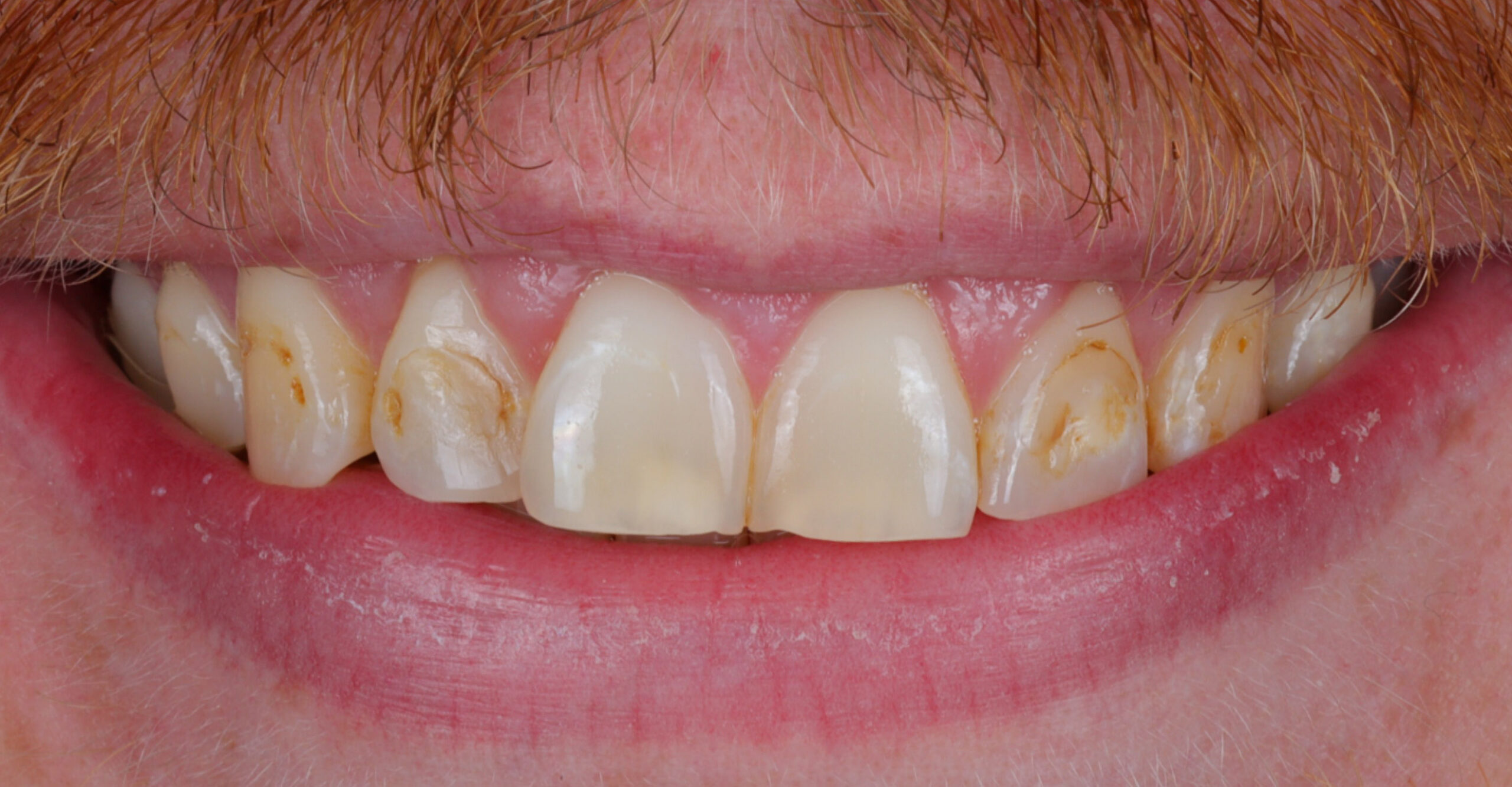 Modern Dentistry of Jupiter | Smile Gallery