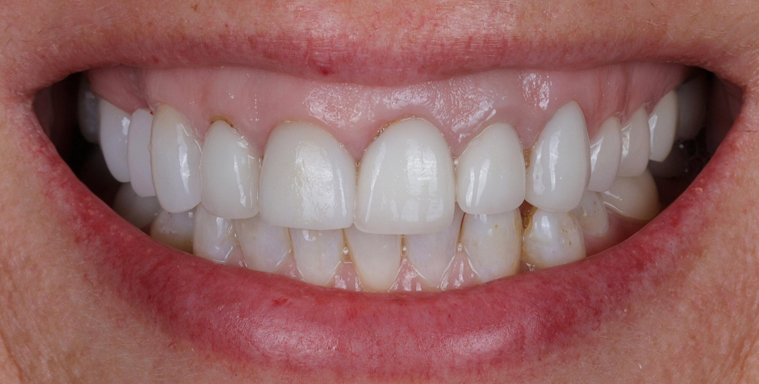 Modern Dentistry of Jupiter | Smile Gallery