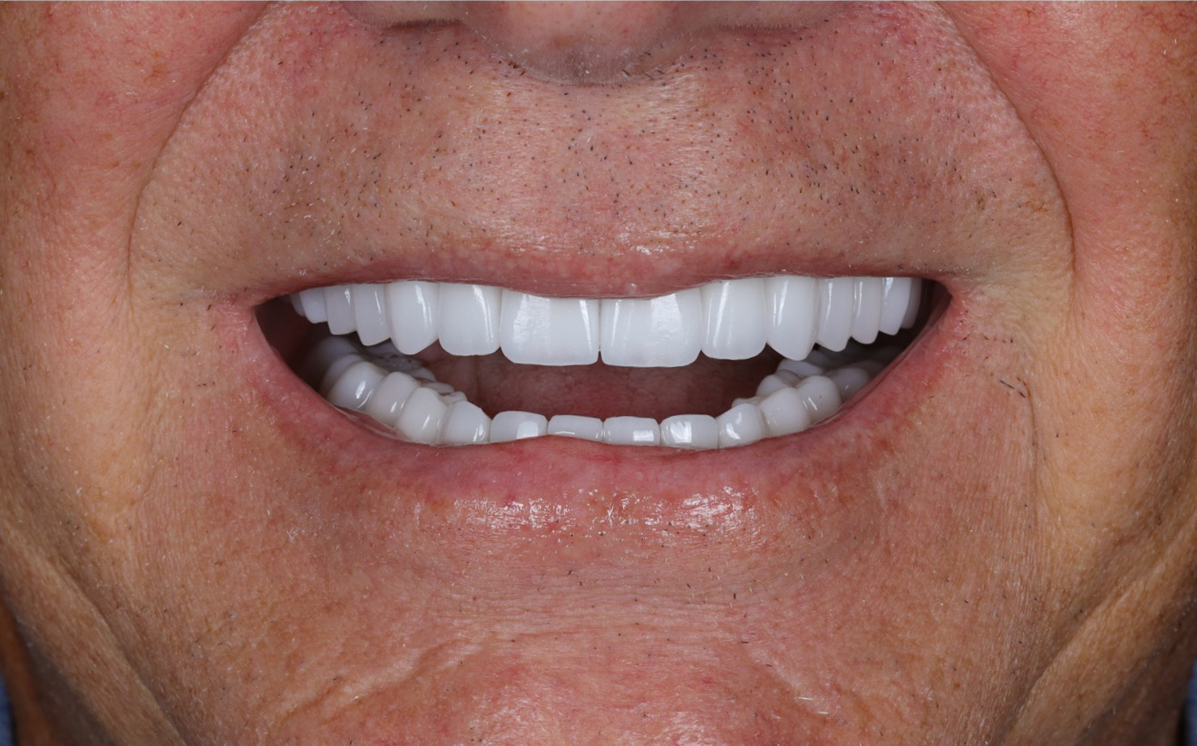 Modern Dentistry of Jupiter | Smile Gallery