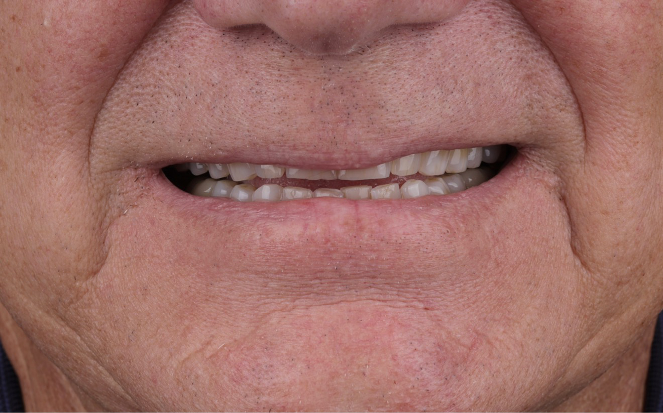 Modern Dentistry of Jupiter | Smile Gallery