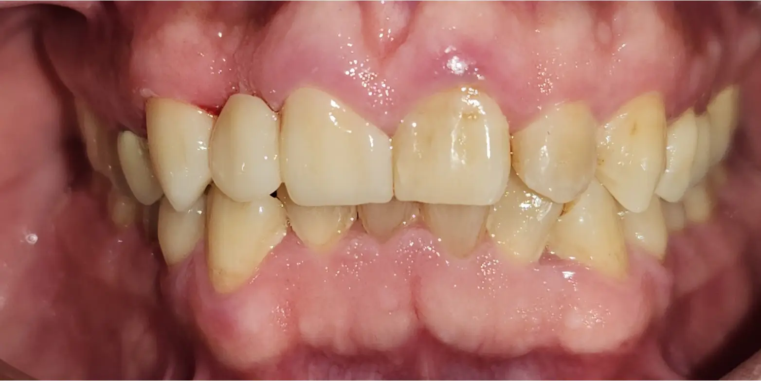 Modern Dentistry of Jupiter | Smile Gallery