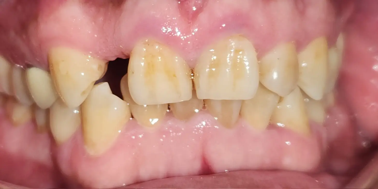 Modern Dentistry of Jupiter | Smile Gallery