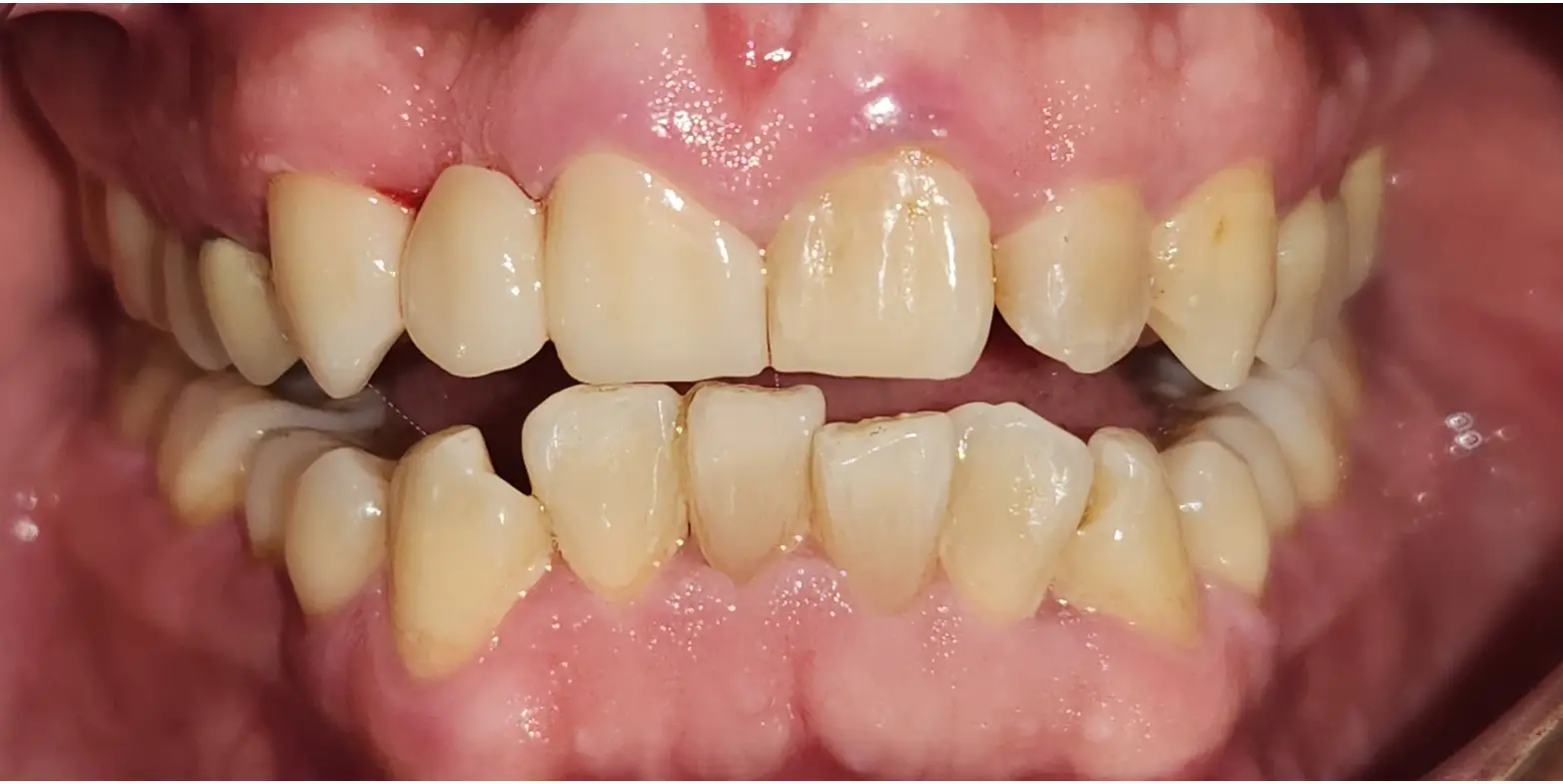Modern Dentistry of Jupiter | Smile Gallery