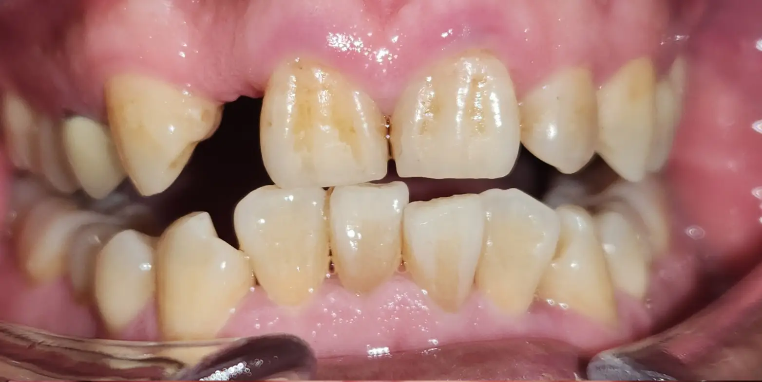 Modern Dentistry of Jupiter | Smile Gallery