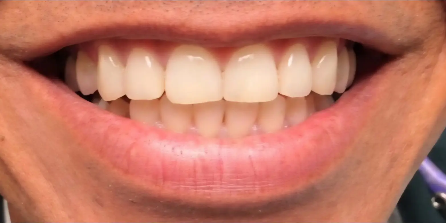 Modern Dentistry of Jupiter | Smile Gallery