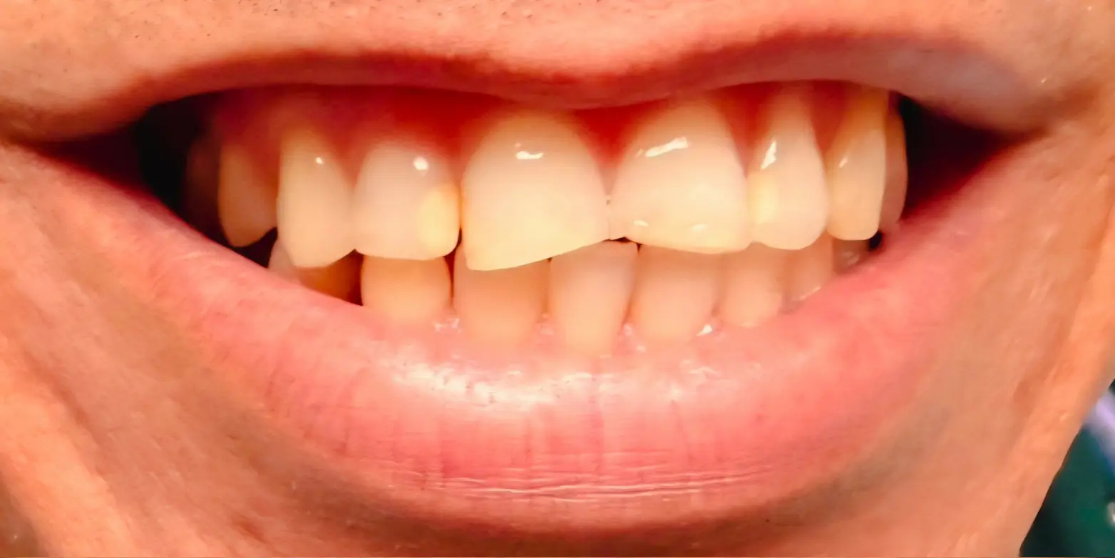 Modern Dentistry of Jupiter | Smile Gallery