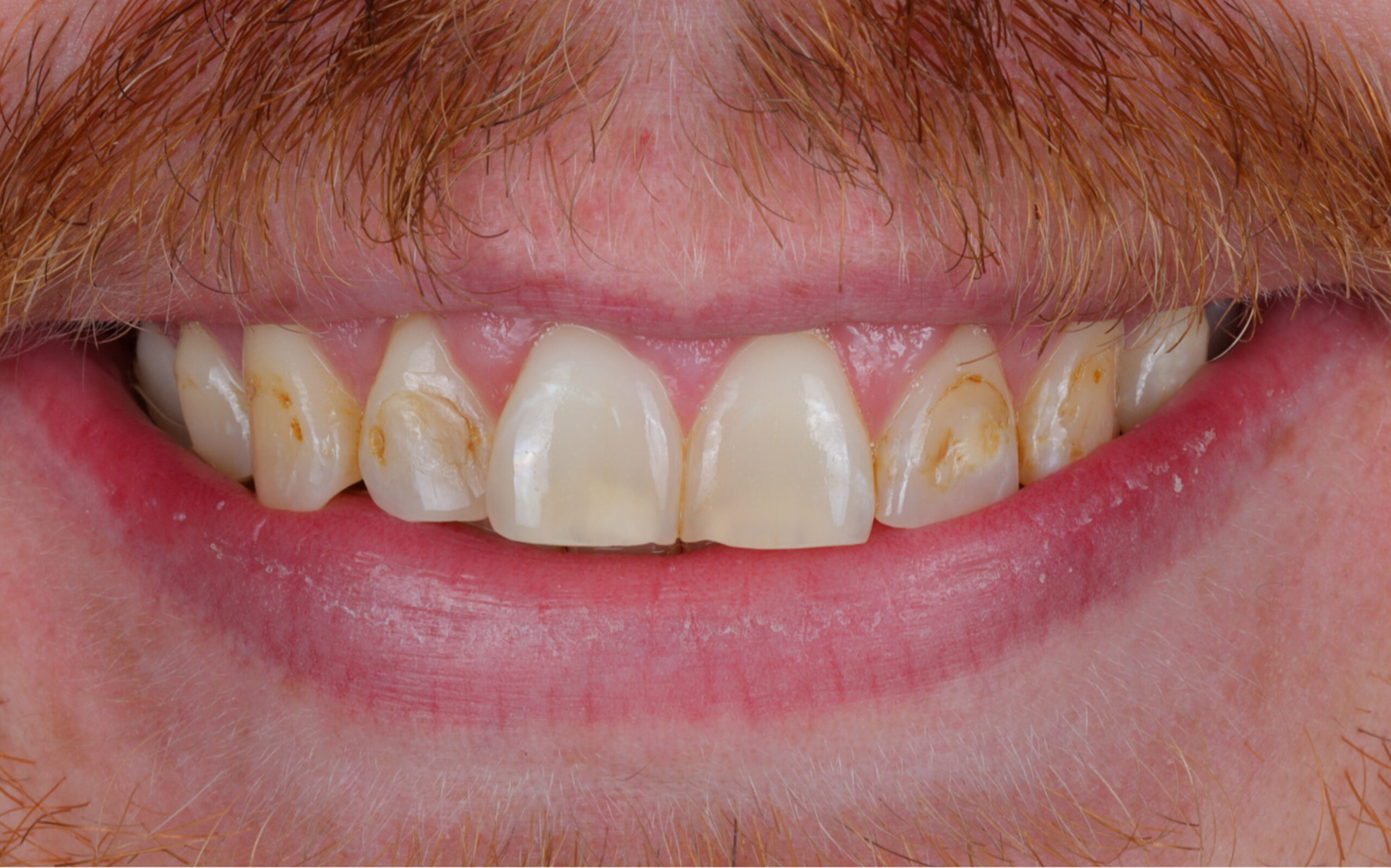 Modern Dentistry of Jupiter | Smile Gallery