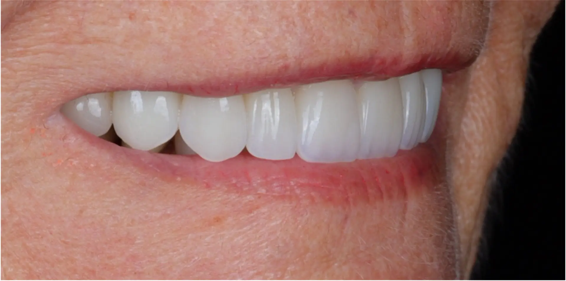 Modern Dentistry of Jupiter | Smile Gallery