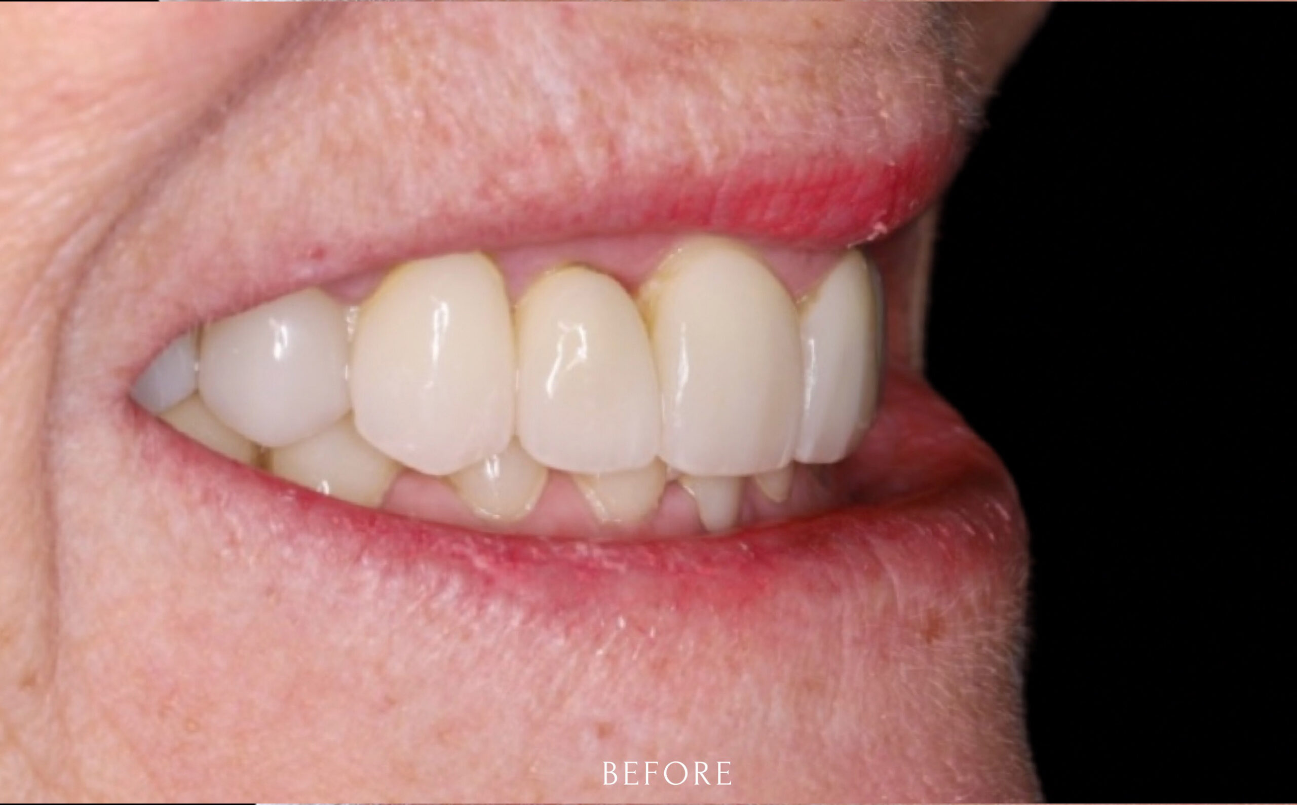 Modern Dentistry of Jupiter | Smile Gallery