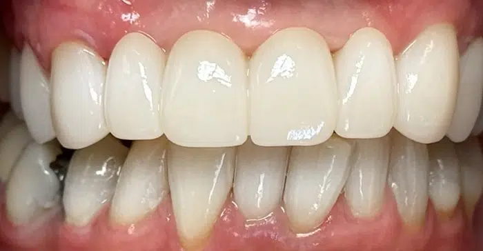Modern Dentistry of Jupiter | Home