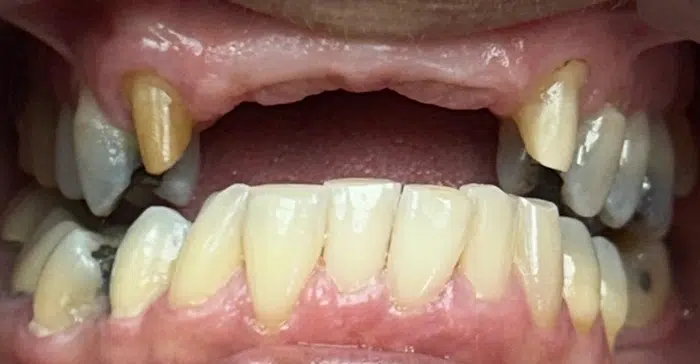 Modern Dentistry of Jupiter | Home