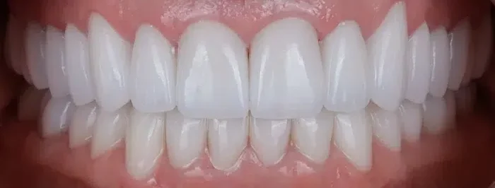 Modern Dentistry of Jupiter | Home