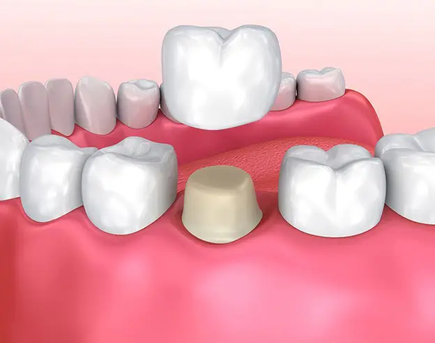 Modern Dentistry of Jupiter | Restorative Dentistry