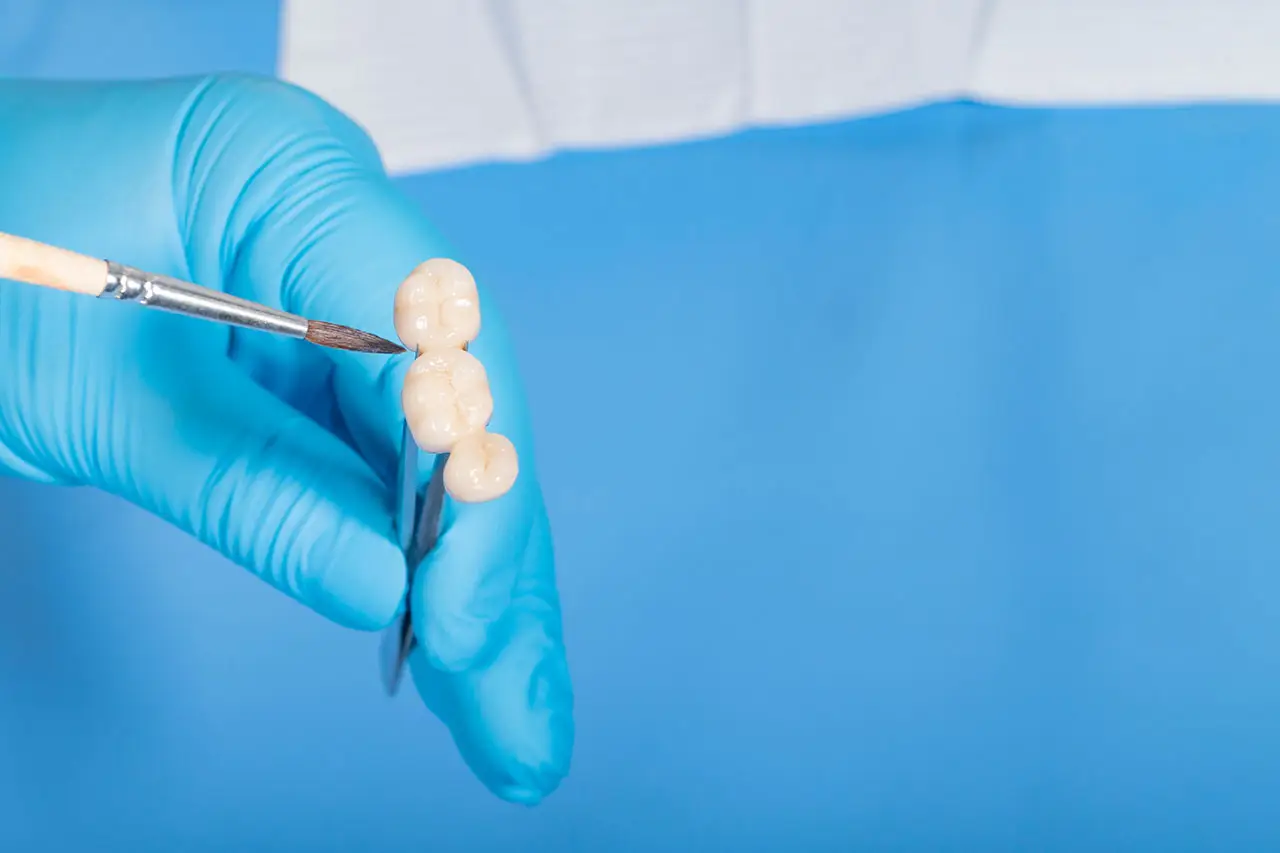 Modern Dentistry of Jupiter | Dental Bridges in Jupiter: A Reliable Way to Replace Missing Teeth