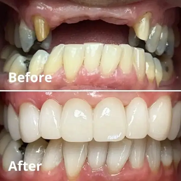 Modern Dentistry of Jupiter | Home